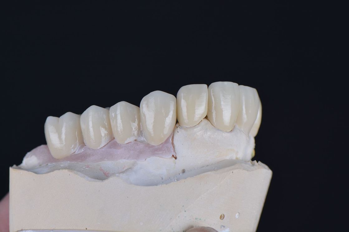 43%～57%の透過性、700～1200 MPaの曲げ強度 YUCERA Dental 98mm オープンシステム CAD/CAM 4D Pro 多層ジルコニアブロック