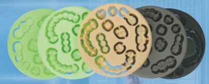 Yucera 高品質 PMMA ディスク、OEM サービス付き歯科材料、歯科技工所向け