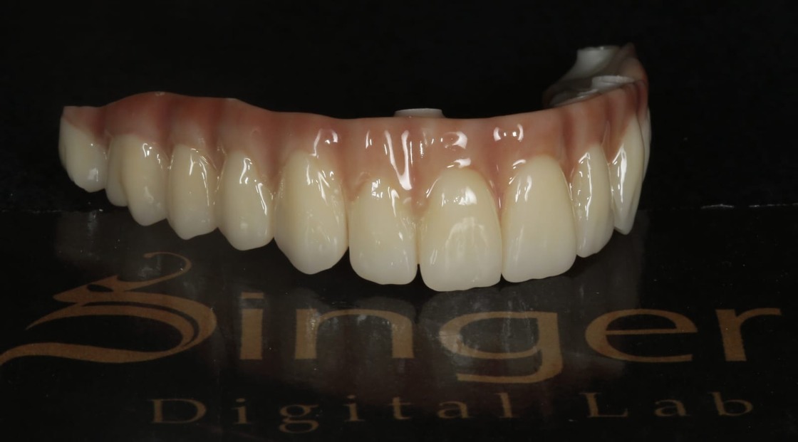 Yucera 4D Pro Dental - HT Plus テクノロジーによる修復物の品質を向上させる特殊ジルコニアセラミックブロック