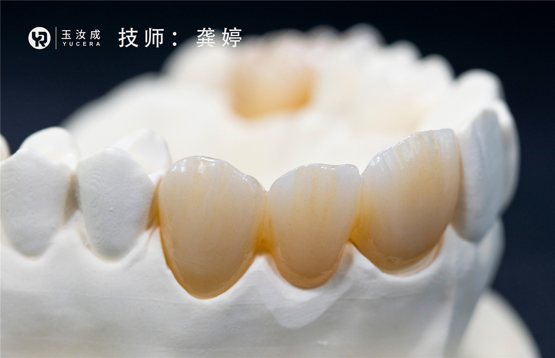 後部の王冠のためのMultilaerのジルコニアのブロック98x16mmの公開システムとYucera 3D